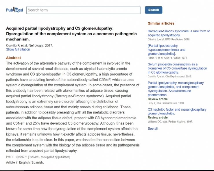 Interesante artículo sobre los mecanismos implicados en la patogenia del síndrome Barraquer-Simons