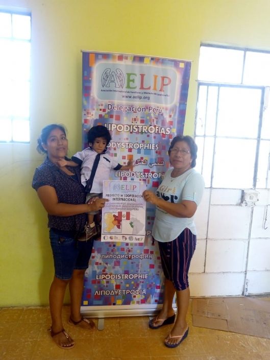 AELIP lleva a cabo la primera acción del proyecto de cooperación internacional en Piura (Perú) con la realización de un estudio de necesidades sociosanitarias a afectados por lipodistrofias en esa zona
