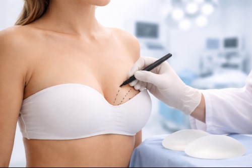 Aumento de mamas Aumento de mamas