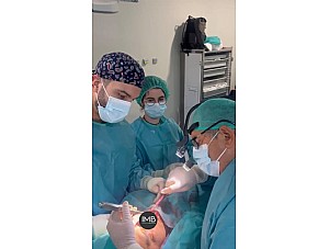 Rinoplastia en Murcia: guía completa y recuperación